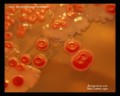 e.coli and proteus